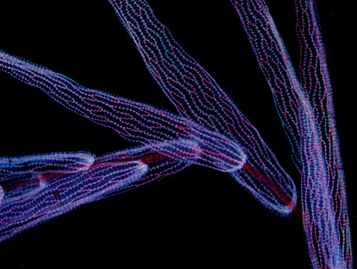 Fotografia mikroskopowa fragmentu gałązki mchu torfowca powiększonego 60 razy i obserwowanego w świetle UV.