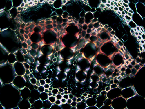 Fotografia mikroskopowa komórek roślinnej wiązki przewodzącej widziana w świetle spolaryzowanym.